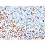 Immunohistochemistry - Anti-Iba1 Antibody [rAIF1/1909] - BSA and Azide free (A251600) - Antibodies.com