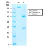 SDS-PAGE - Anti-Iba1 Antibody [rAIF1/1909] - BSA and Azide free (A251600) - Antibodies.com