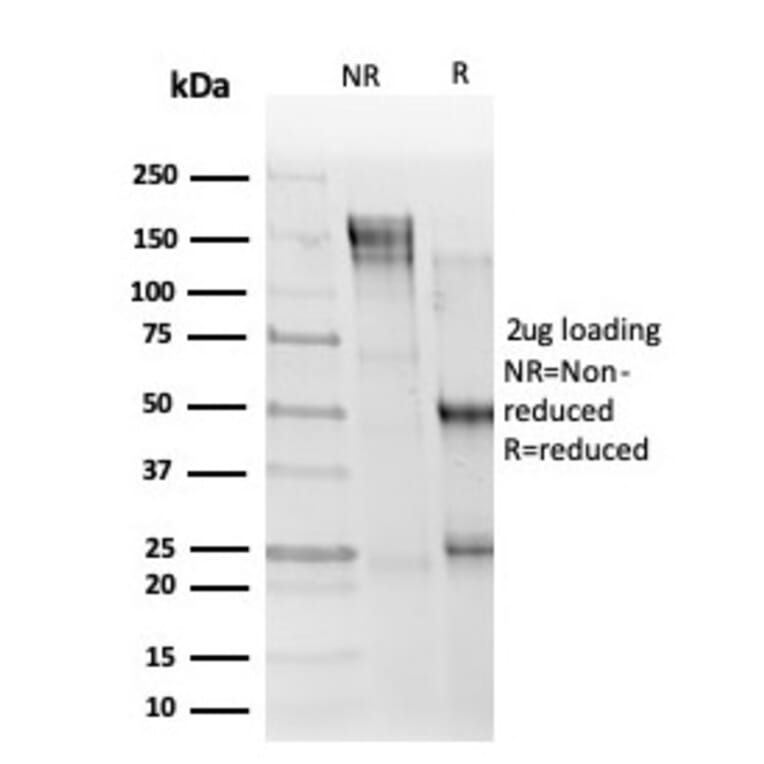 SDS-PAGE - Anti-ELK1 Antibody [PCRP-ELK1-1B9] - BSA and Azide free (A251602) - Antibodies.com