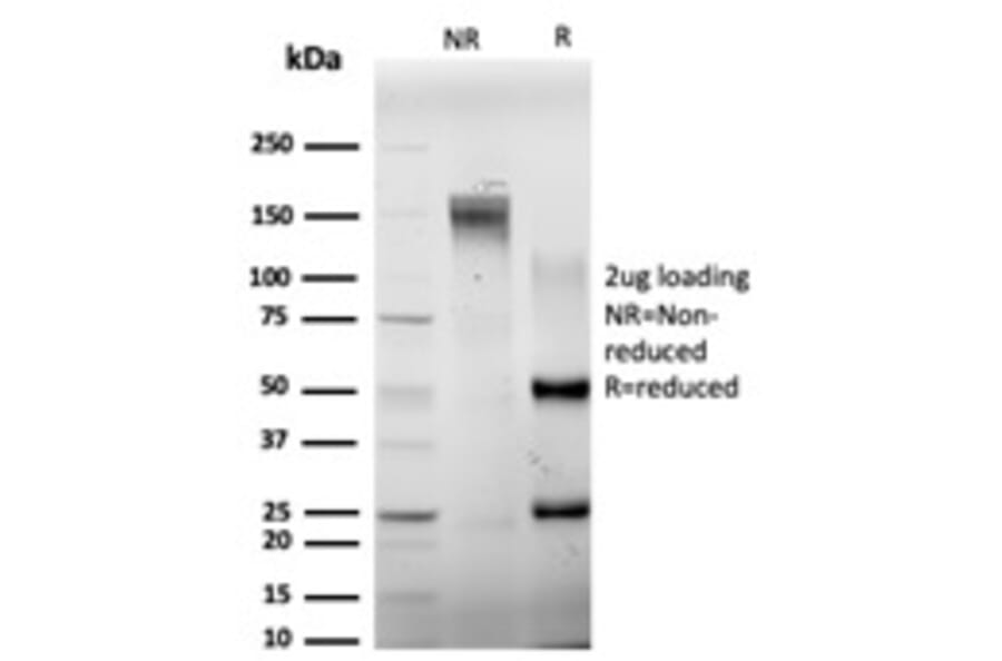 SDS-PAGE - Anti-ELK1 Antibody [PCRP-ELK1-1D9] - BSA and Azide free (A251603) - Antibodies.com
