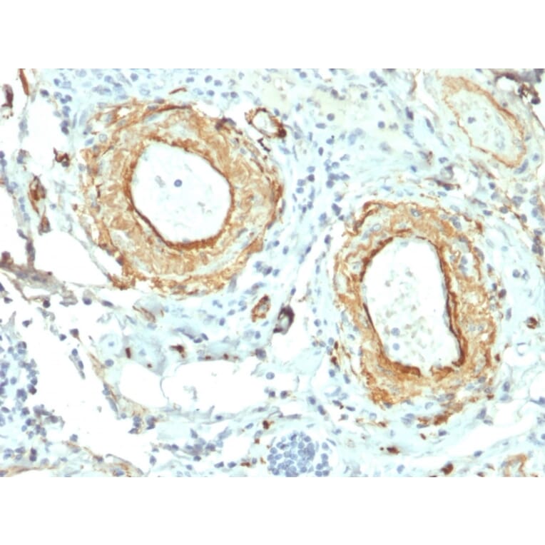 Immunohistochemistry - Anti-Elastin Antibody [ELN/2069] - BSA and Azide free (A251605) - Antibodies.com