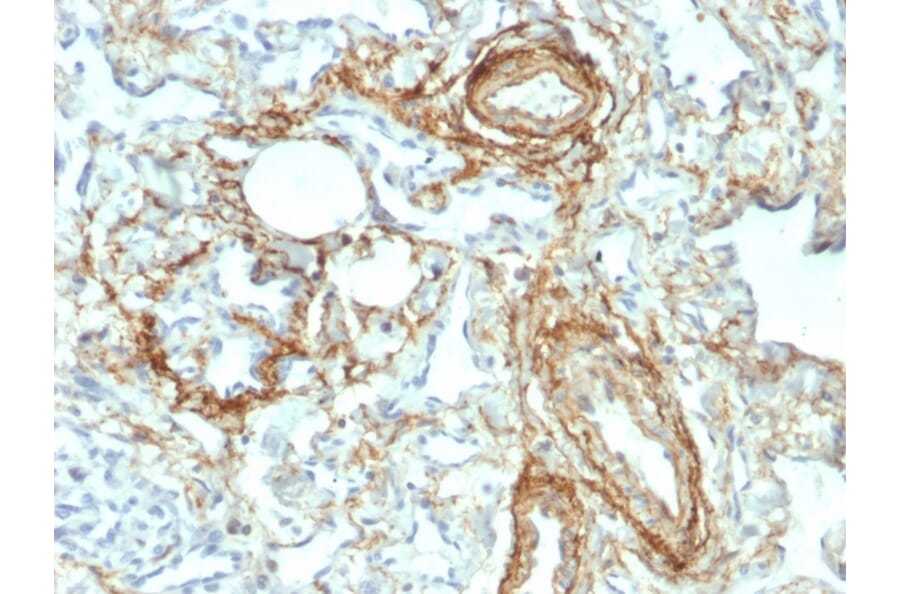 Immunohistochemistry - Anti-Elastin Antibody [ELN/2069] - BSA and Azide free (A251604) - Antibodies.com