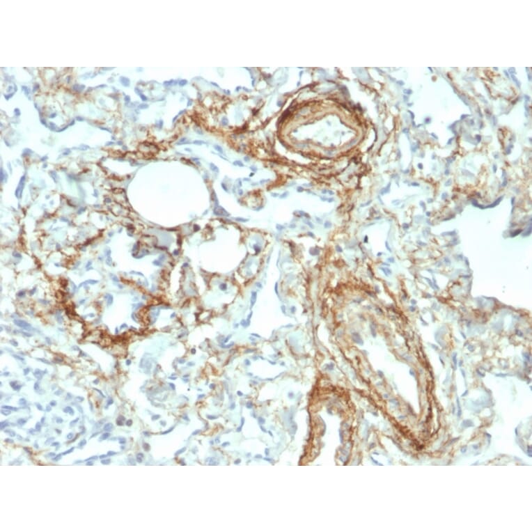 Immunohistochemistry - Anti-Elastin Antibody [ELN/2069] - BSA and Azide free (A251604) - Antibodies.com
