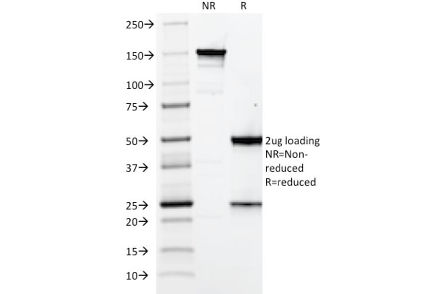 SDS-PAGE - Anti-Elastin Antibody [ELN/2069] - BSA and Azide free (A251605) - Antibodies.com