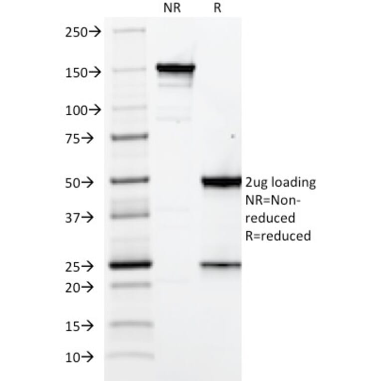 SDS-PAGE - Anti-Elastin Antibody [ELN/2069] - BSA and Azide free (A251605) - Antibodies.com