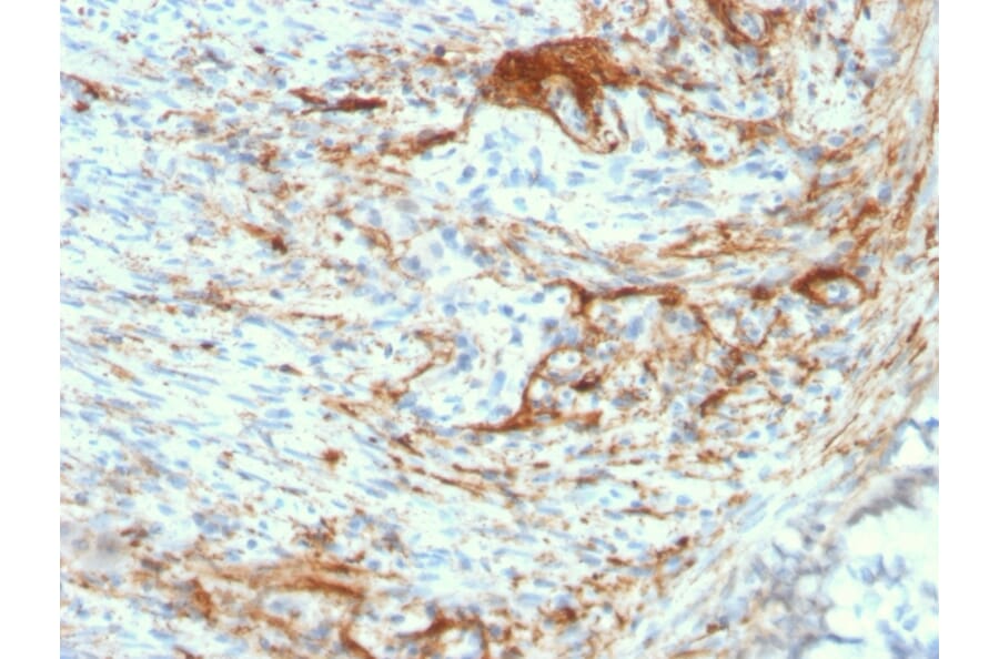 Immunohistochemistry - Anti-Elastin Antibody [ELN/3131R] - BSA and Azide free (A251606) - Antibodies.com
