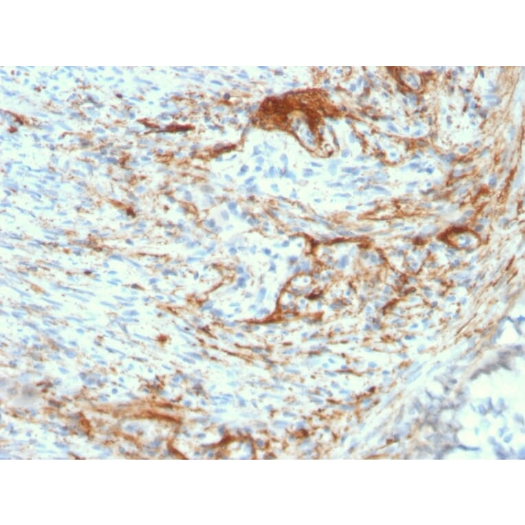 Immunohistochemistry - Anti-Elastin Antibody [ELN/3131R] - BSA and Azide free (A251606) - Antibodies.com