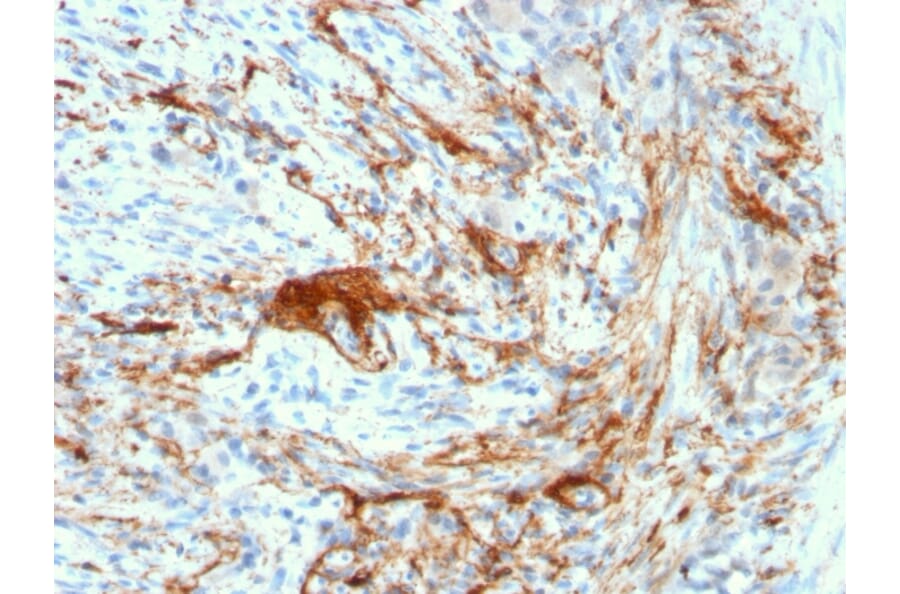 Immunohistochemistry - Anti-Elastin Antibody [ELN/3131R] - BSA and Azide free (A251605) - Antibodies.com