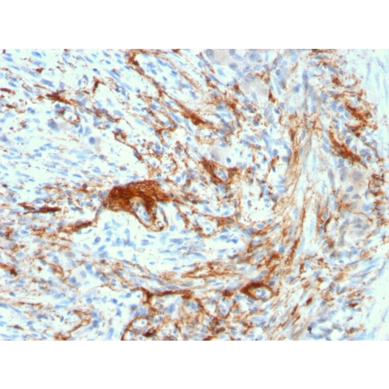 Immunohistochemistry - Anti-Elastin Antibody [ELN/3131R] - BSA and Azide free (A251605) - Antibodies.com