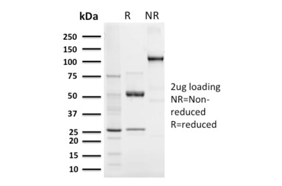 SDS-PAGE - Anti-Elastin Antibody [ELN/3131R] - BSA and Azide free (A251606) - Antibodies.com