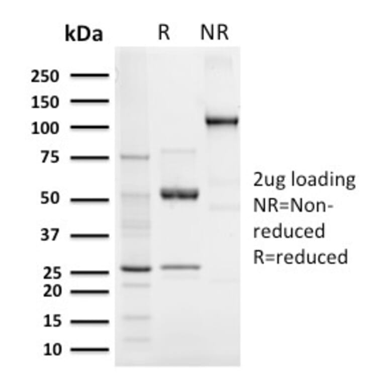 SDS-PAGE - Anti-Elastin Antibody [ELN/3131R] - BSA and Azide free (A251606) - Antibodies.com