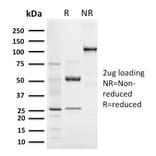 SDS-PAGE - Anti-Elastin Antibody [ELN/3131R] - BSA and Azide free (A251606) - Antibodies.com