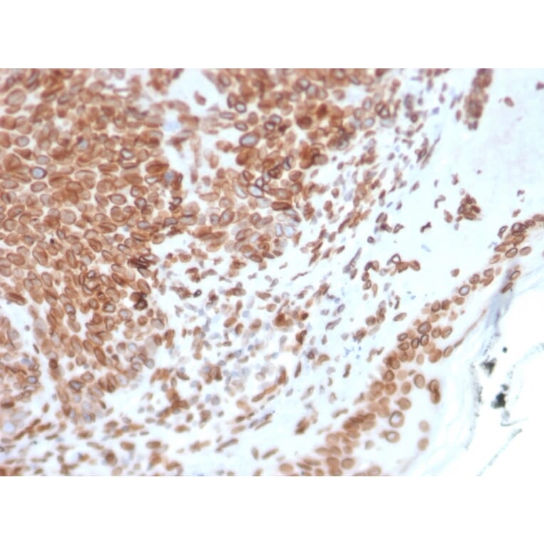 Immunohistochemistry - Anti-Emerin Antibody [EMD/2168] - BSA and Azide free (A251608) - Antibodies.com