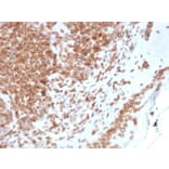 Immunohistochemistry - Anti-Emerin Antibody [EMD/2168] - BSA and Azide free (A251608) - Antibodies.com
