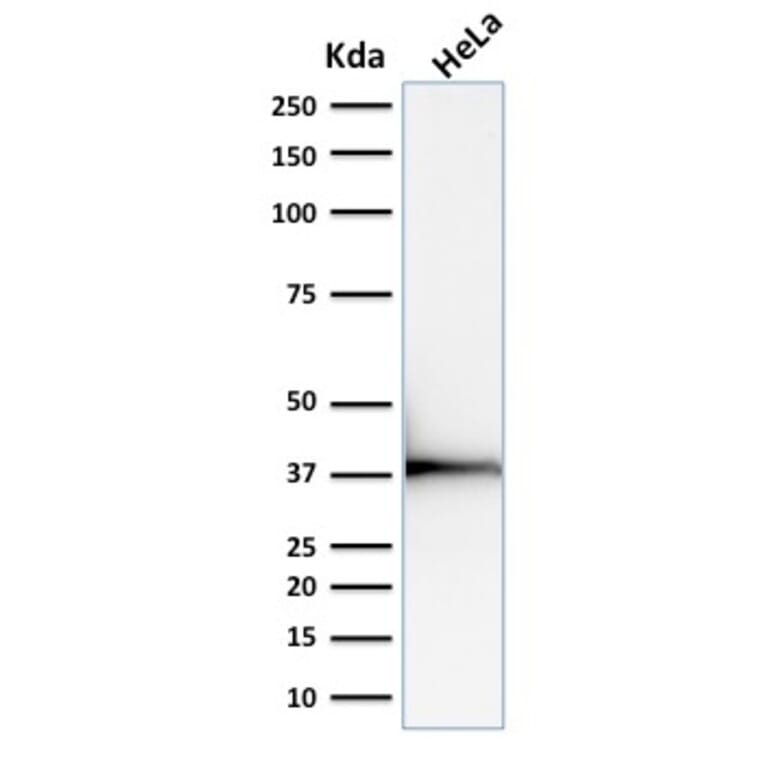 Western Blot - Anti-Emerin Antibody [EMD/2168] - BSA and Azide free (A251608) - Antibodies.com