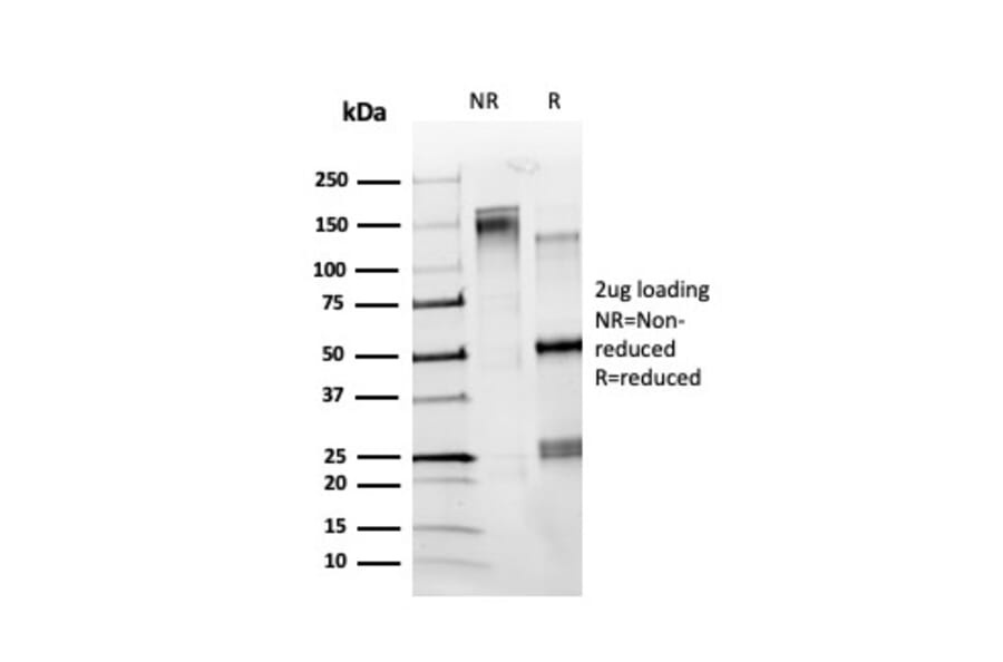 SDS-PAGE - Anti-ZBTB7C Antibody [PCRP-ZBTB7C-4E12] - BSA and Azide free (A251609) - Antibodies.com