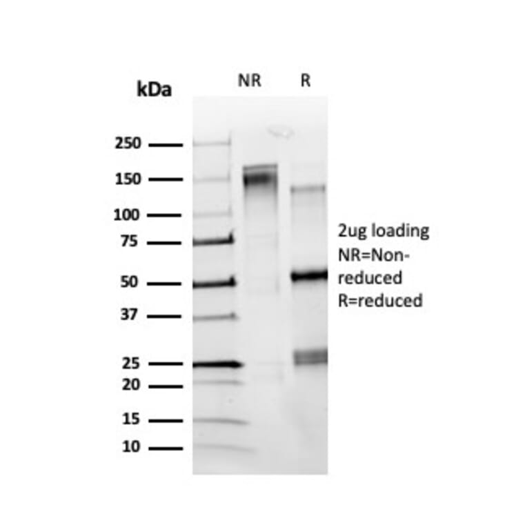 SDS-PAGE - Anti-ZBTB7C Antibody [PCRP-ZBTB7C-4E12] - BSA and Azide free (A251609) - Antibodies.com