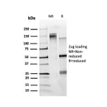 SDS-PAGE - Anti-ZBTB7C Antibody [PCRP-ZBTB7C-4E12] - BSA and Azide free (A251609) - Antibodies.com