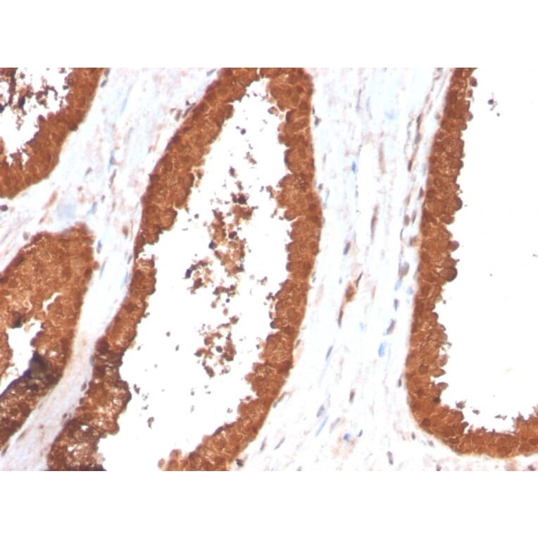 Immunohistochemistry - Anti-TIGIT Antibody [TIGIT/3017] - BSA and Azide free (A251610) - Antibodies.com