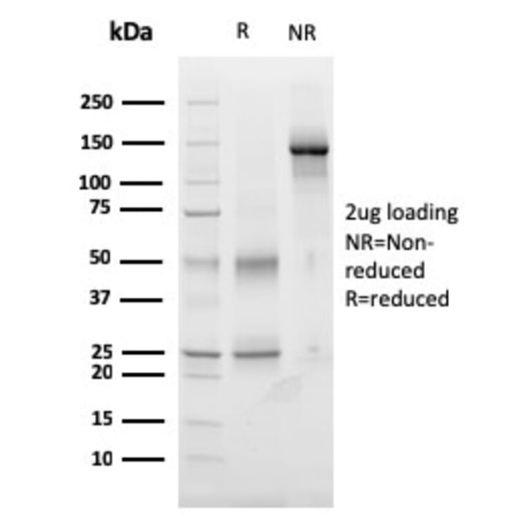 SDS-PAGE - Anti-TIGIT Antibody [TIGIT/3017] - BSA and Azide free (A251610) - Antibodies.com