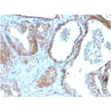 Immunohistochemistry - Anti-TIGIT Antibody [TIGIT/3106] - BSA and Azide free (A251611) - Antibodies.com
