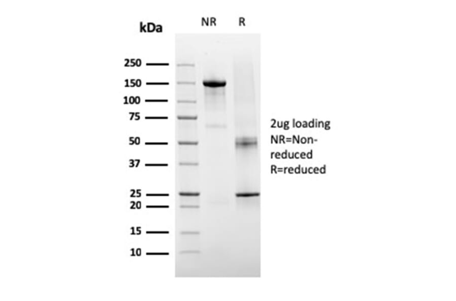 SDS-PAGE - Anti-TIGIT Antibody [TIGIT/3106] - BSA and Azide free (A251611) - Antibodies.com