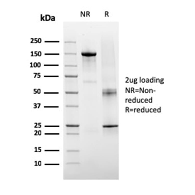 SDS-PAGE - Anti-TIGIT Antibody [TIGIT/3106] - BSA and Azide free (A251611) - Antibodies.com