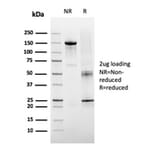SDS-PAGE - Anti-TIGIT Antibody [TIGIT/3106] - BSA and Azide free (A251611) - Antibodies.com