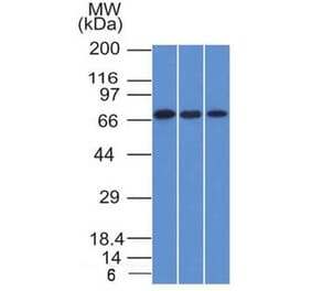 Western Blot - Anti-CD105 Antibody [ENG/1326] - BSA and Azide free (A251612) - Antibodies.com