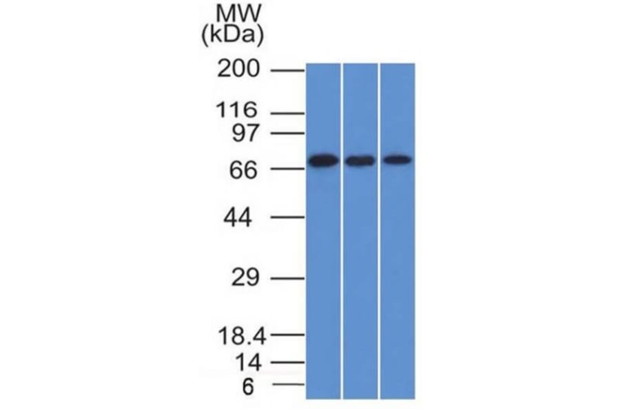 Western Blot - Anti-CD105 Antibody [ENG/1326] - BSA and Azide free (A251612) - Antibodies.com