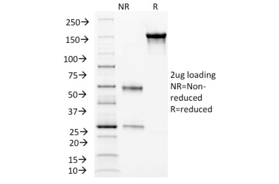 SDS-PAGE - Anti-CD105 Antibody [ENG/1326] - BSA and Azide free (A251611) - Antibodies.com