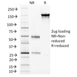 SDS-PAGE - Anti-CD105 Antibody [ENG/1326] - BSA and Azide free (A251611) - Antibodies.com