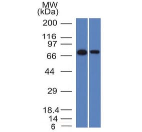 Western Blot - Anti-CD105 Antibody [ENG/1327] - BSA and Azide free (A251613) - Antibodies.com