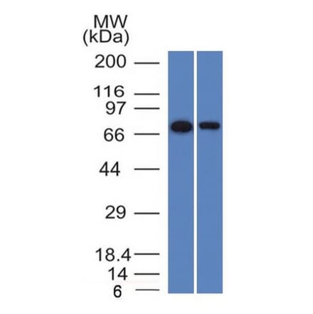 Western Blot - Anti-CD105 Antibody [ENG/1327] - BSA and Azide free (A251613) - Antibodies.com