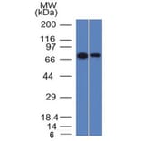 Western Blot - Anti-CD105 Antibody [ENG/1327] - BSA and Azide free (A251613) - Antibodies.com