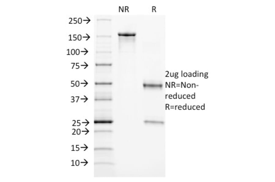 SDS-PAGE - Anti-CD105 Antibody [ENG/1327] - BSA and Azide free (A251612) - Antibodies.com