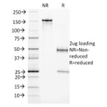 SDS-PAGE - Anti-CD105 Antibody [ENG/1327] - BSA and Azide free (A251612) - Antibodies.com