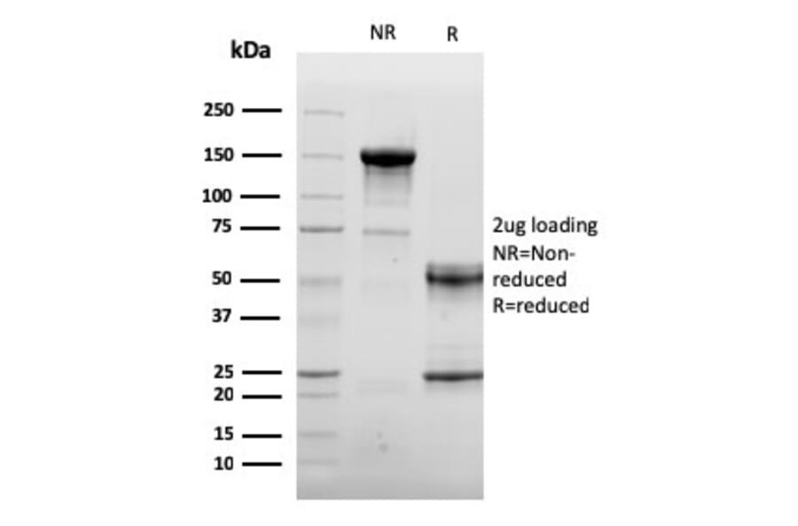 SDS-PAGE - Anti-CD105 Antibody [ENG/3269] - BSA and Azide free (A251614) - Antibodies.com