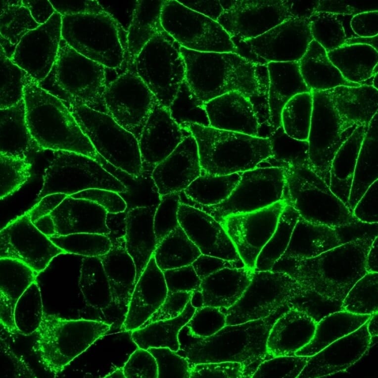 Immunofluorescence - Anti-CD105 Antibody [ENG/1621] - BSA and Azide free (A251615) - Antibodies.com