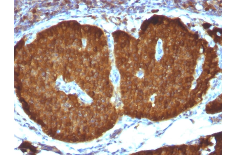 Immunohistochemistry - Anti-Neuron Specific Enolase Antibody [ENO2/1375] - BSA and Azide free (A251616) - Antibodies.com