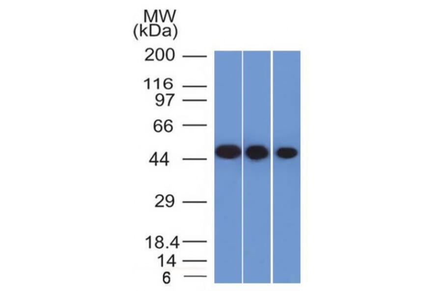Western Blot - Anti-Neuron Specific Enolase Antibody [ENO2/1375] - BSA and Azide free (A251616) - Antibodies.com