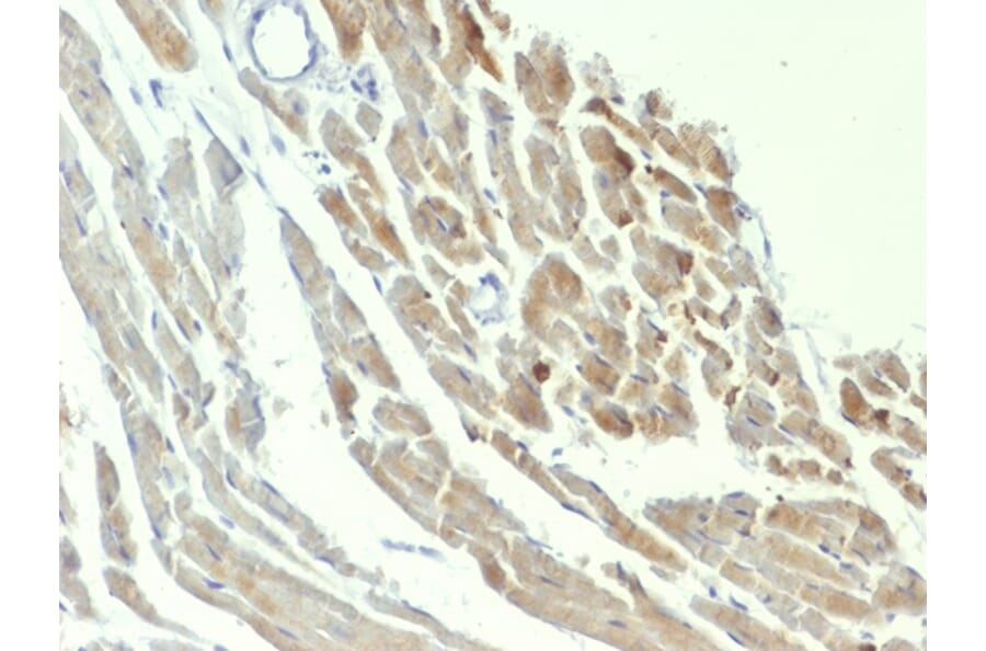 Immunohistochemistry - Anti-Neuron Specific Enolase Antibody [ENO2/1375] - BSA and Azide free (A251616) - Antibodies.com