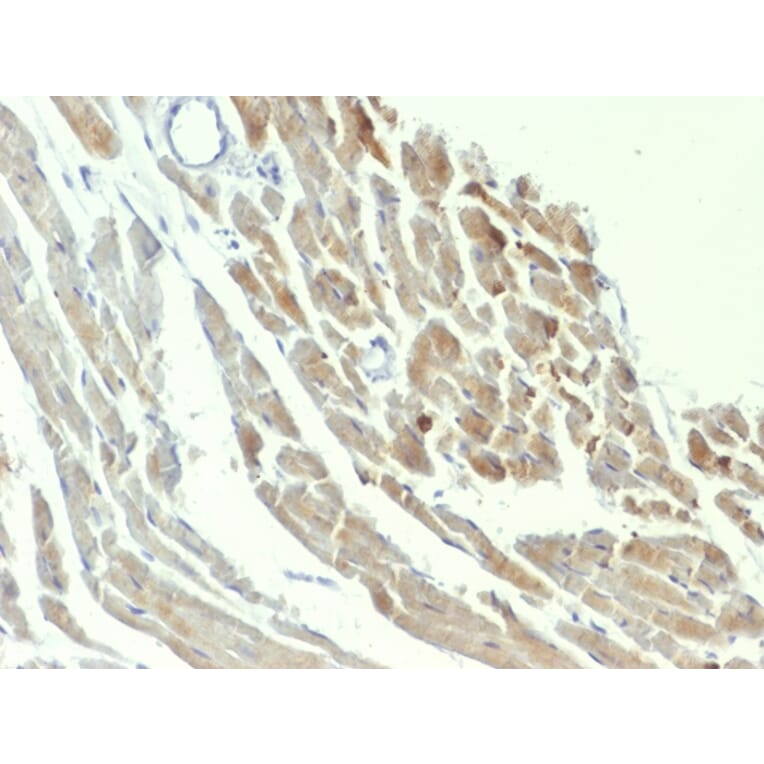 Immunohistochemistry - Anti-Neuron Specific Enolase Antibody [ENO2/1375] - BSA and Azide free (A251616) - Antibodies.com