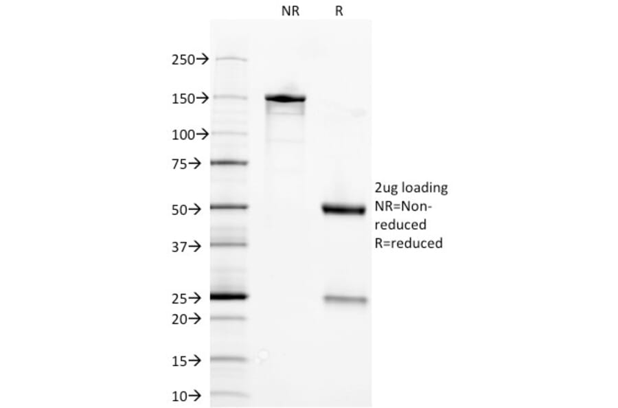 SDS-PAGE - Anti-Neuron Specific Enolase Antibody [ENO2/1375] - BSA and Azide free (A251616) - Antibodies.com