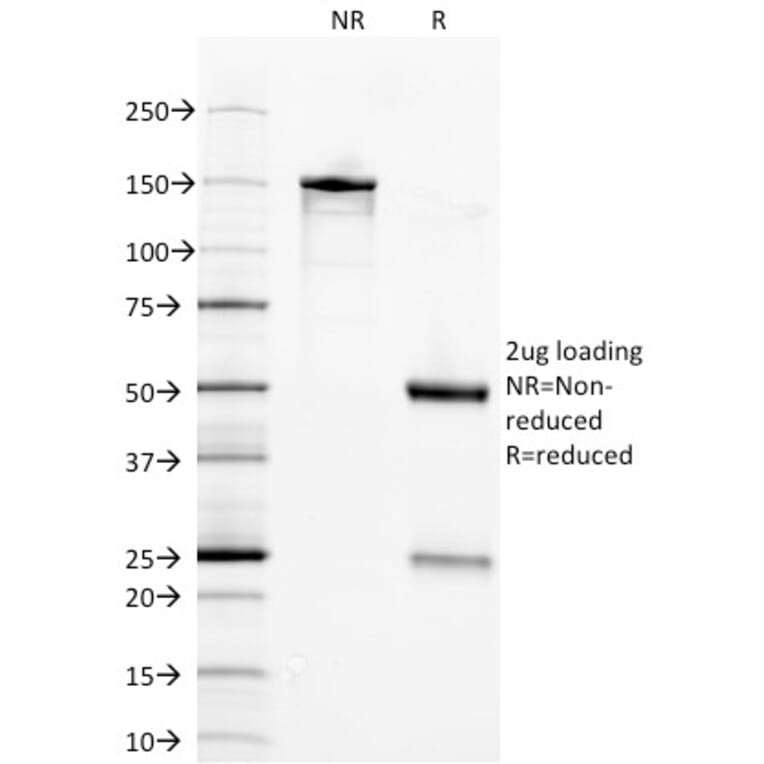 SDS-PAGE - Anti-Neuron Specific Enolase Antibody [ENO2/1375] - BSA and Azide free (A251616) - Antibodies.com