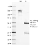 SDS-PAGE - Anti-Neuron Specific Enolase Antibody [ENO2/1375] - BSA and Azide free (A251616) - Antibodies.com
