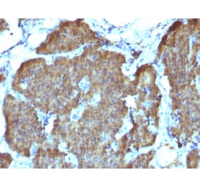 Immunohistochemistry - Anti-Neuron Specific Enolase Antibody [SPM347] - BSA and Azide free (A251616) - Antibodies.com