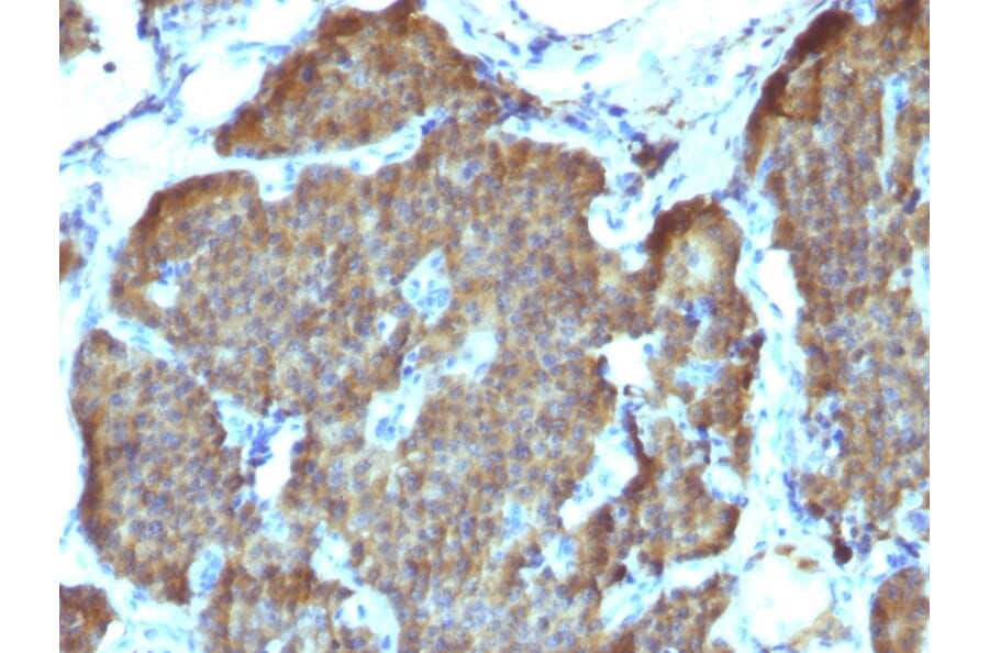 Immunohistochemistry - Anti-Neuron Specific Enolase Antibody [SPM347] - BSA and Azide free (A251616) - Antibodies.com