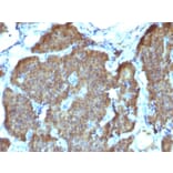 Immunohistochemistry - Anti-Neuron Specific Enolase Antibody [SPM347] - BSA and Azide free (A251616) - Antibodies.com