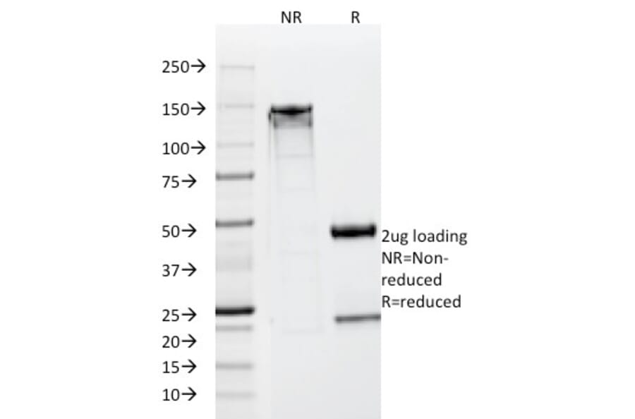 SDS-PAGE - Anti-Neuron Specific Enolase Antibody [SPM347] - BSA and Azide free (A251617) - Antibodies.com